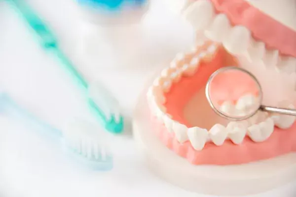 むし歯の治療方法