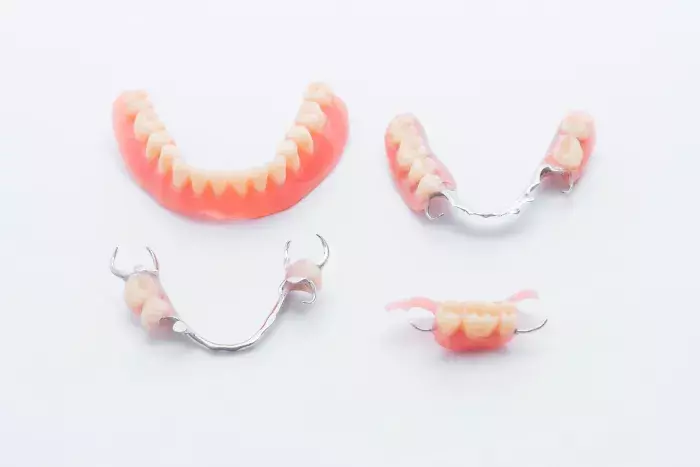 入れ歯・義歯の治療法・種類